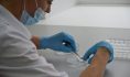 Случаи бешенства установили в лаборатории.