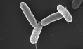 Salmonella typhimurium.