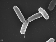 Salmonella typhimurium.