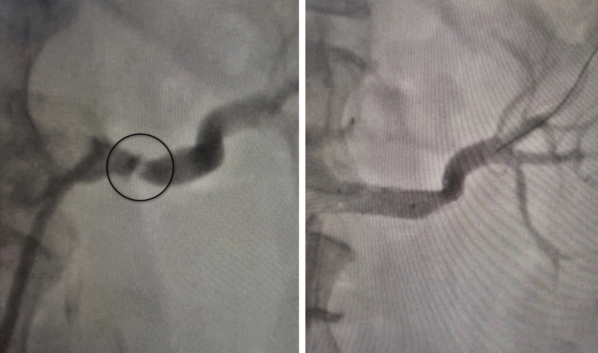 До операции и после.